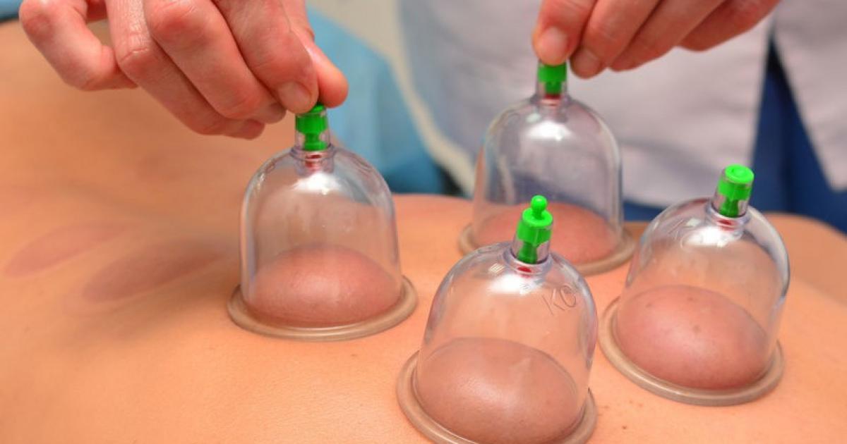 اسرار – أفضل أيام الحجامة في شعبان 2026: دليل التمر وفوائده الصحية