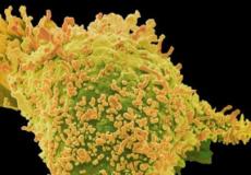 هناك عوامل وراثية تتدخل في الإصابة بالسرطان