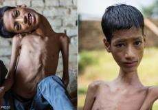 الطفل كان عاجزا عن ممارسة حياته الطبيعية