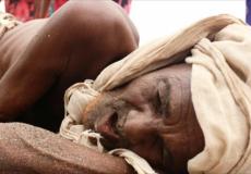 ارتفاع حالات الاشتباه بالكوليرا باليمن