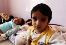 تعرض أطفال يمنيون إلى الإصابة بوباء الكوليرا