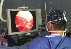 عملية جراحية لاستئصال أورام في المقاصد