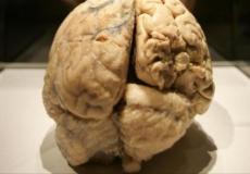 دماغ انسان