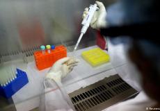 فحص كورونا - ارشيفية