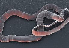 دودة شريطية