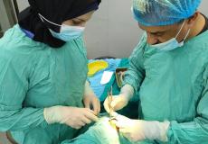 مستشفى العيون يستأصل ورم بحجم 1.8سم من حجر العين اليسرى لطفلة