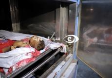 أحد الشهداء الأطفال في غزة بعد وصوله إلى المستشفى