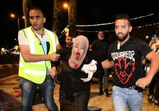عشرات الإصابات خلال مواجهات في القدس ومحيطها