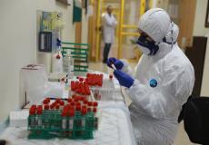 طبيبة فلسطينية تفحص عينات فيروس كورونا