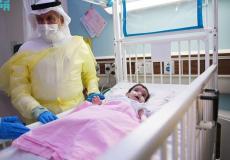 التوأم الطفيلي اليمني عائشة