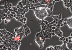 تسلل فيروس كورونا لخلايا الدماغ