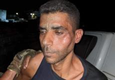 صورة تظهر اعتداء الاحتلال على زكريا الزبيدي