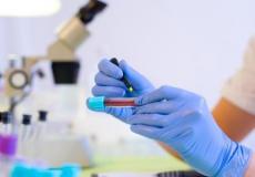 سحب عينات دم في الصين