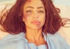 قصة الاعتداء على دوللي شاهين ودخولها المستشفى