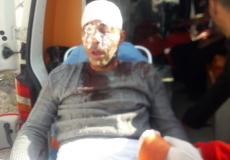 جانب من الاعتداء على المزارعين في نابلس