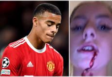 ماسون جرينوود  وصديقته بعد الاعتداء