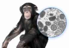 مرض جدري القرود