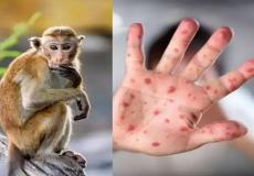 الإمارات تعلن تسجيل 4 حالات جديدة لـ"جدري القردة"