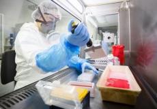 طبيب يفحص عينات لمتحور أوميكرون - توضيحية