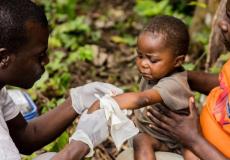 الحصبة في زيمبابوي