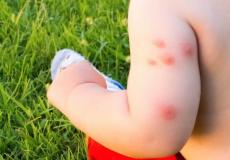 الغذاء والدواء: نصائح لتجنب لدغات البعوض.