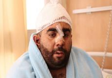 الإسرائيلي الذي يزعم الشاباك بأن الفلسطينيين حاولوا قتله