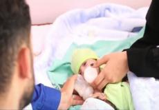 بتوجيهات من خادم الحرمين ..وصول التوأم السيامي العراقي إلى السعودية