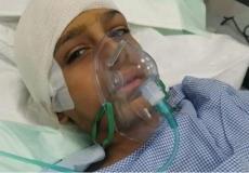 طالب يتعرض لكسر في الجمجمة بالسعودية