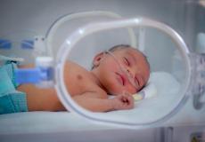 طفل مصاب بمتلازمة الضائقة التنفسية - توضيحية