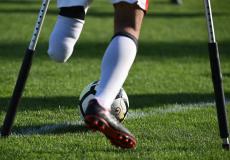 لاعب مبتور الساق يسجل هدفاً عالمياً.