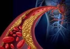 علامات في جسم الإنسان تكشف ارتفاع نسبة الكوليسترول