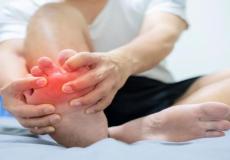 تورم الأقدام.. الأسباب وطرق العلاج