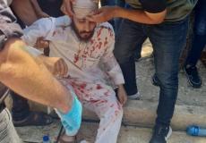 مواطن مصاب جرّاء اعتداءات الاحتلال عند باب الأسباط