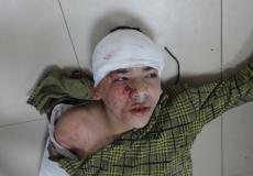 الأمم المتحدة: 70% من شهداء غزة من النساء والأطفال