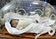 ارتفاع حصيلة شهداء المجاعة بين الأطفال في غزة