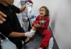 طفلة مصابة من القصف الإسرائيلي