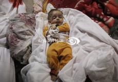 طفل شهيد في غزة