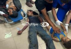 حصيلة الشهداء والجرحى بعد 228 يوما على حرب غزة