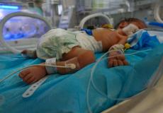 سوء التغذية في غزة خطر على حديثي الولادة