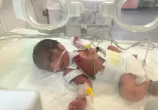 ارتفاع التشوهات الخلقية لدى المواليد في غزة