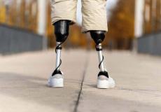 الأردن - تركيب 30 طرفا صناعيا لفلسطينيين في غزة