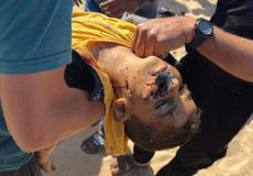 19 شهيدا في مجزرة عيادة الأونروا بجباليا