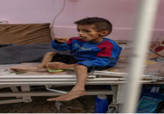 أطفال غزة.. ضحايا الحصار الغذائي والتجويع المتعمّد