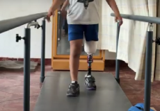 مبتورو الأطراف في غزة