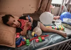 بتر الأطراف لدى الأطفال في غزة