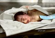 وفاة طفل نتيجة البرد القارس في مواصي خانيونس 