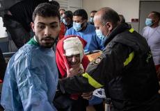 مصابون جراء القصف على لبنان - أرشيف