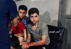 أطفال مصابون جراء القصف الإسرائيلي الليلة على غزة