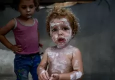 أمراض جلدية في غزة