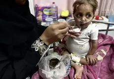 التقزّم والهزال يهدّدان أطفال غزة